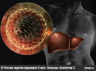 Большинство больных гепатитом С - трудоспособные граждане - фото № 3