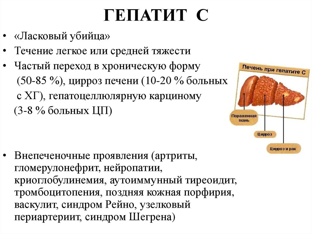 Сложность выздоровления от вирусного гепатита С - фото № 2