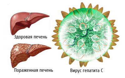 Безопасность терапии ВГС при назначении новых лекарств - фото № 2