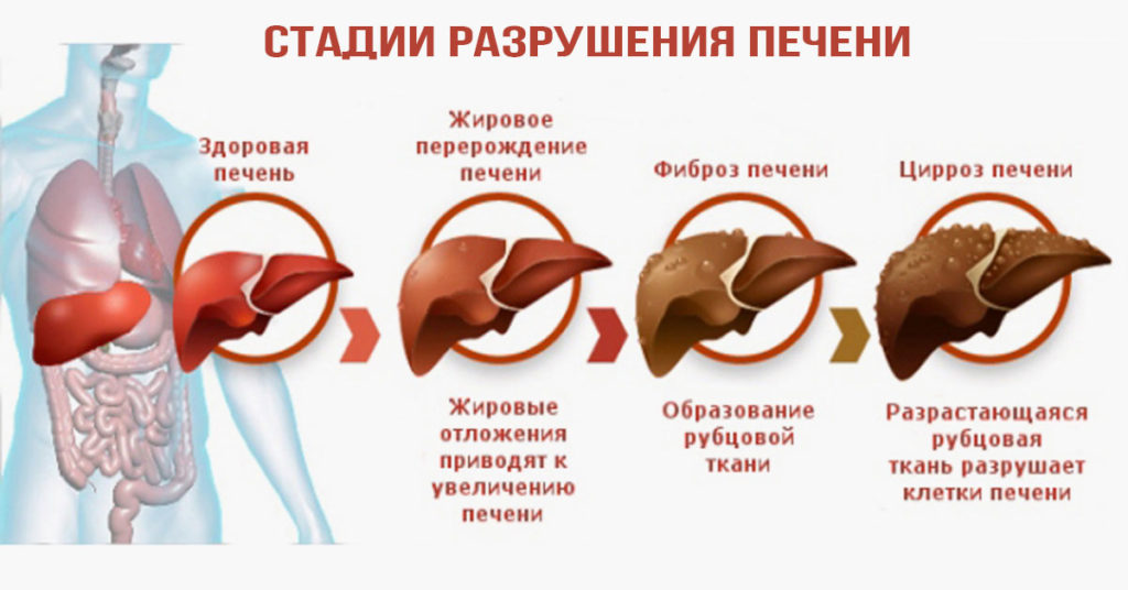 Причины негативного отношения к ПППД от гепатита С - фото № 1