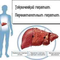 Переболеть гепатитом С без последствий