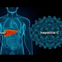 Гепатит С и иммунная система: опасное противостояние