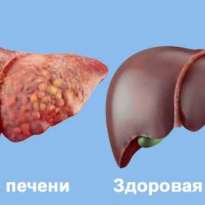 Отечественные проблемы, зарубежные лекарства от ВГС