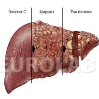 Генетические факторы для успеха лечения гепатита С